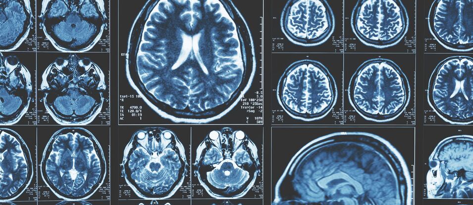 Update Neurologie und Neuroreha 2026