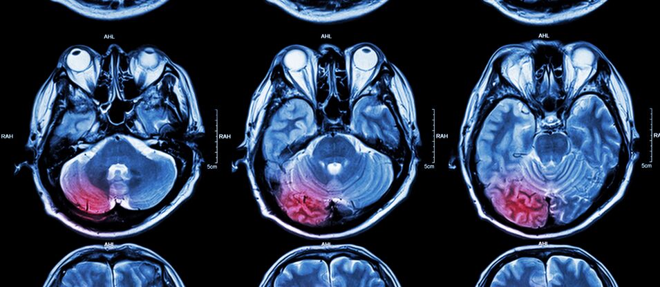 Neurologische Notfälle